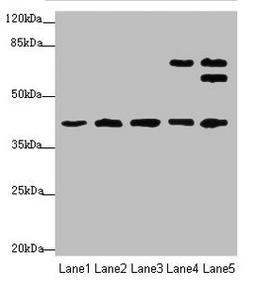 Western blot. All lanes: IKBIPantibody at 4.49ug/ml. Lane 1: Mouse kidney tissue. Lane 2: Mouse lung tissue. Lane 3: Mouse spleen tissue. Lane 4: HL60 whole cell lysate. Lane 5: HepG2 whole cell lysate. Secondary. Goat polyclonal to rabbit IgG at 1/10000 dilution. Predicted band size: 40, 28, 8, 44 kDa. Observed band size: 40, 67, 63 kDa. 