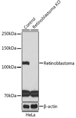 Western blot - Retinoblastoma antibody (A3618)