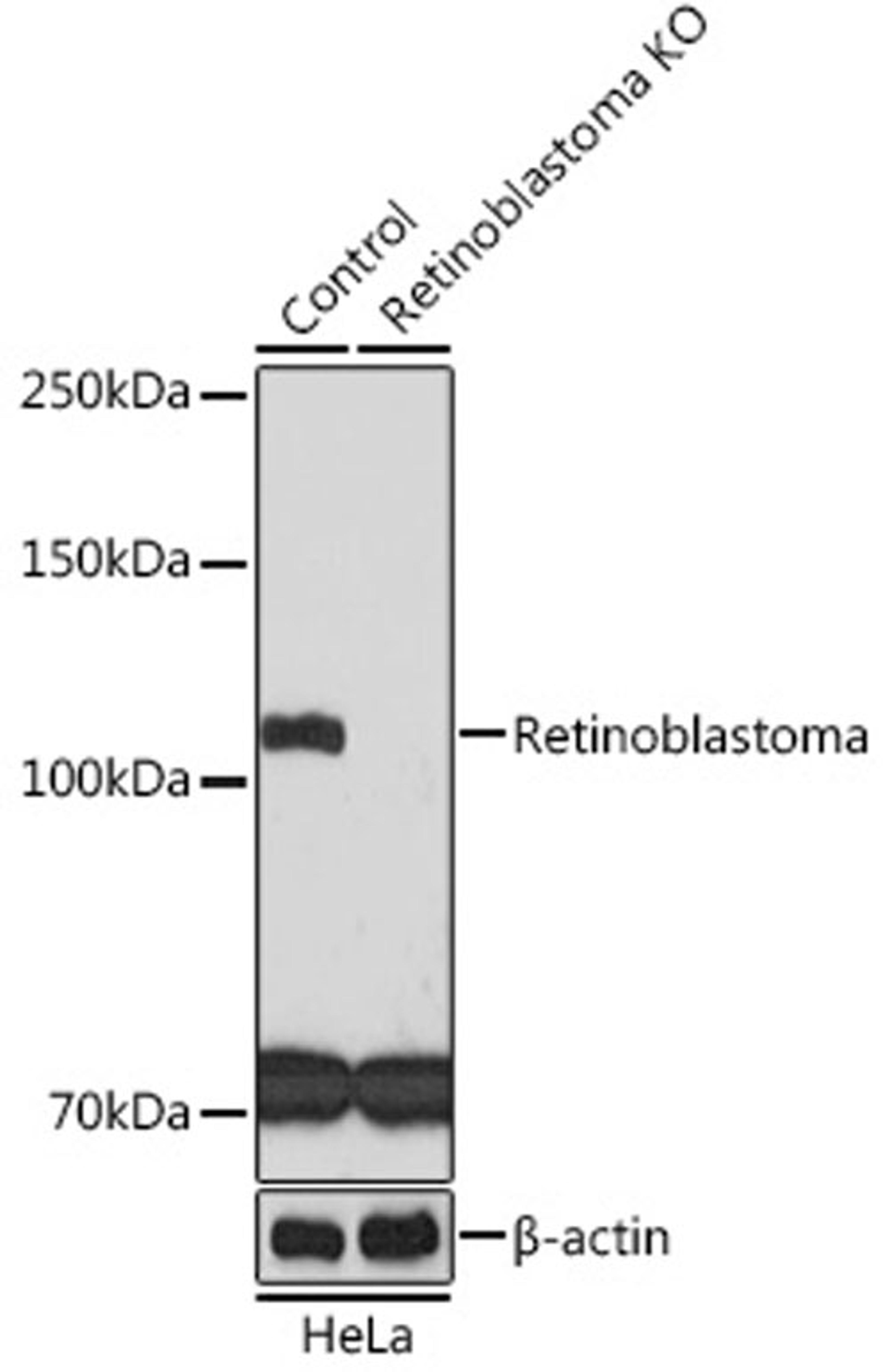 Western blot - Retinoblastoma antibody (A3618)