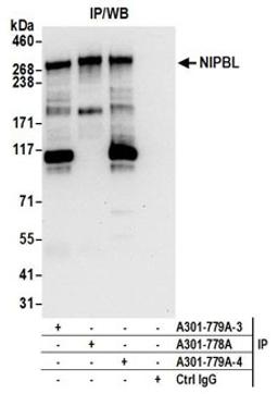 Detection of human NIPBL by western blot of immunoprecipitates.