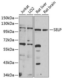 Western blot - SELP antibody (A1425)