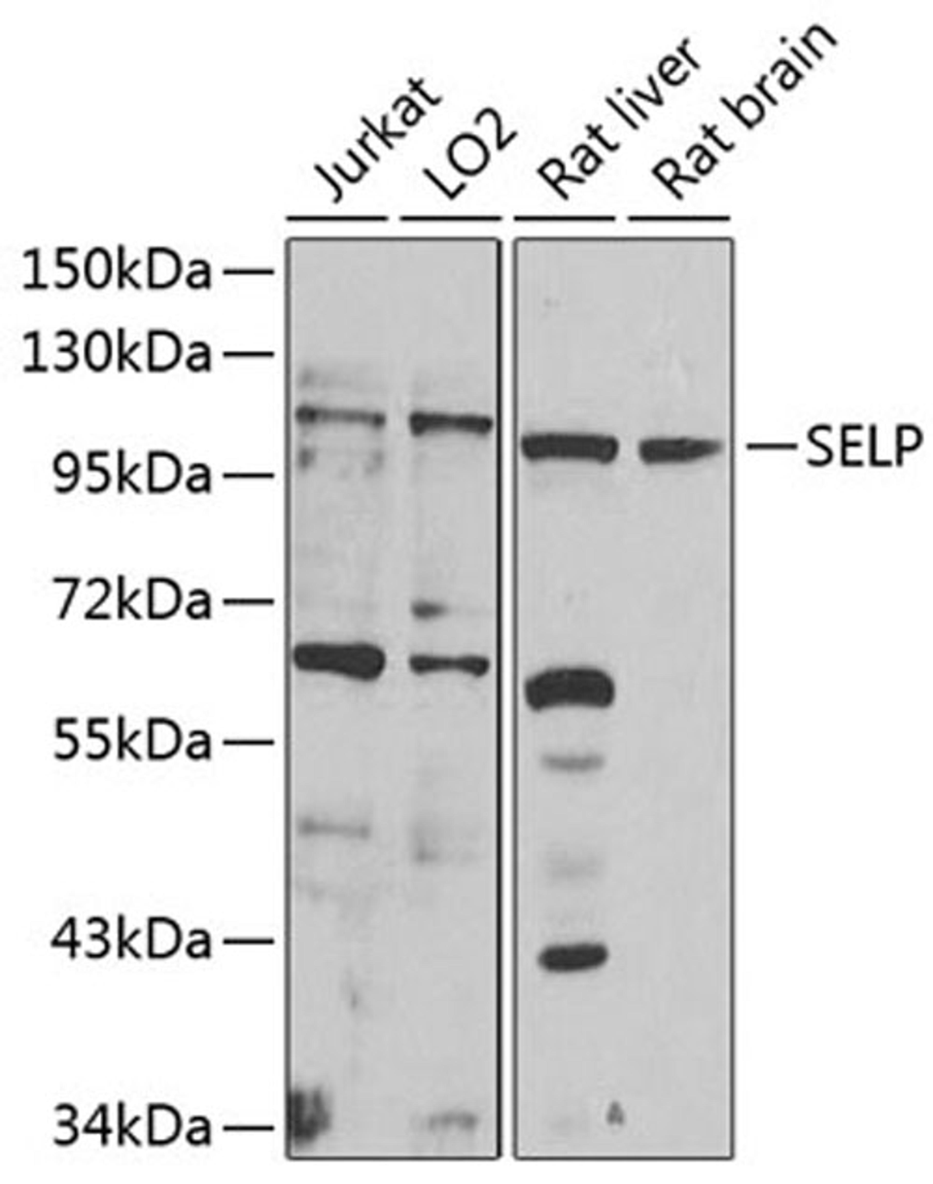 Western blot - SELP antibody (A1425)