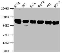 Western Blot. Positive WB detected in: K562 whole cell lysate, 293 whole cell lysate, Hela whole cell lysate, HepG2 whole cell lysate, PC3 whole cell lysate, MCF-7 whole cell lysate. All lanes: ITCH antibody at 1:2000. Secondary. Goat polyclonal to rabbit IgG at 1/50000 dilution. Predicted band size: 103, 99, 87 kDa. Observed band size: 103 kDa.