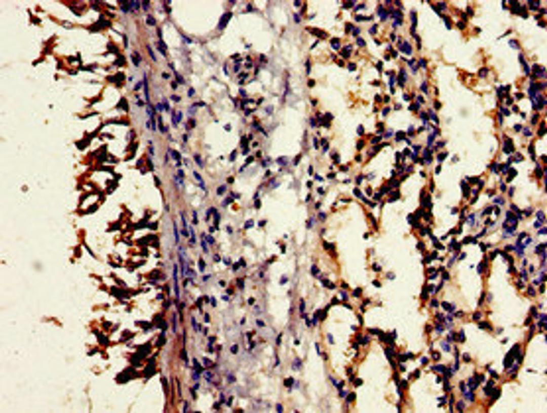 Immunohistochemistry of paraffin-embedded human lung tissue using CSB-PA004945LA01HU at dilution of 1:100