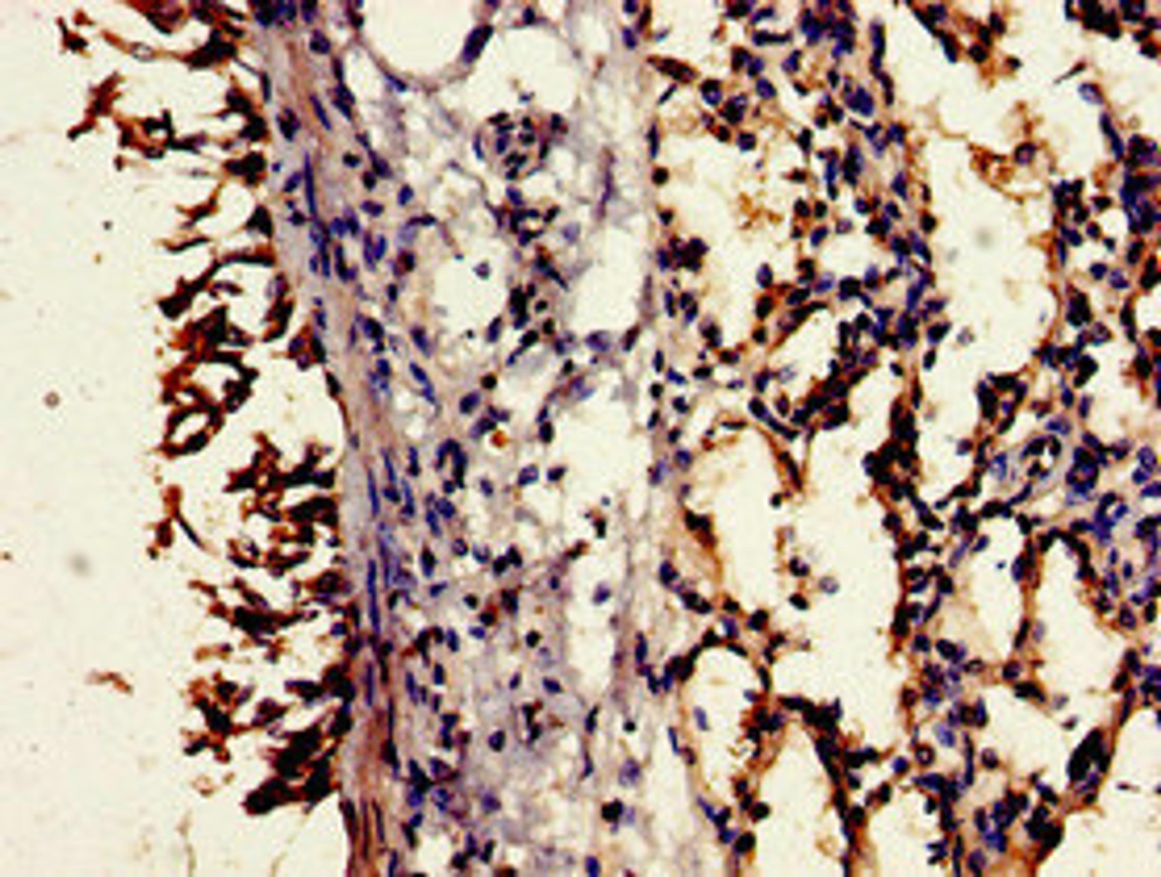 Immunohistochemistry of paraffin-embedded human lung tissue using CSB-PA004945LA01HU at dilution of 1:100
