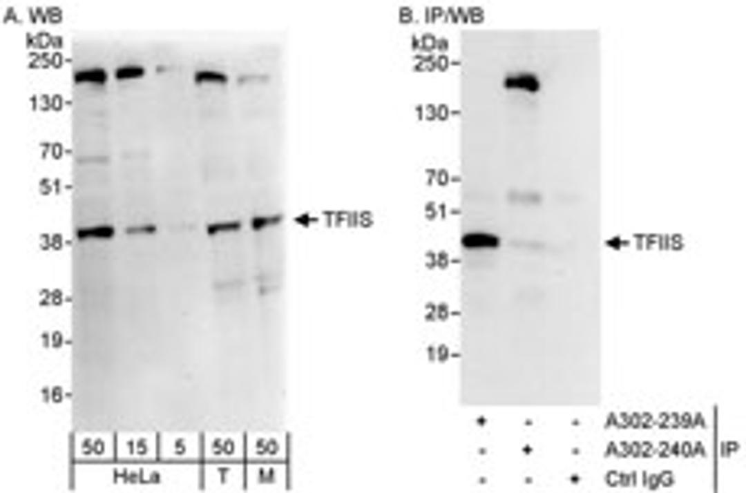 Detection of human and mouse TFIIS by western blot (h&m) and immunoprecipitation (h).