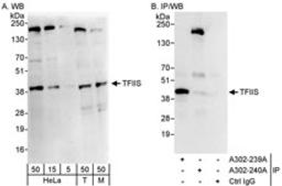 Detection of human and mouse TFIIS by western blot (h&m) and immunoprecipitation (h).