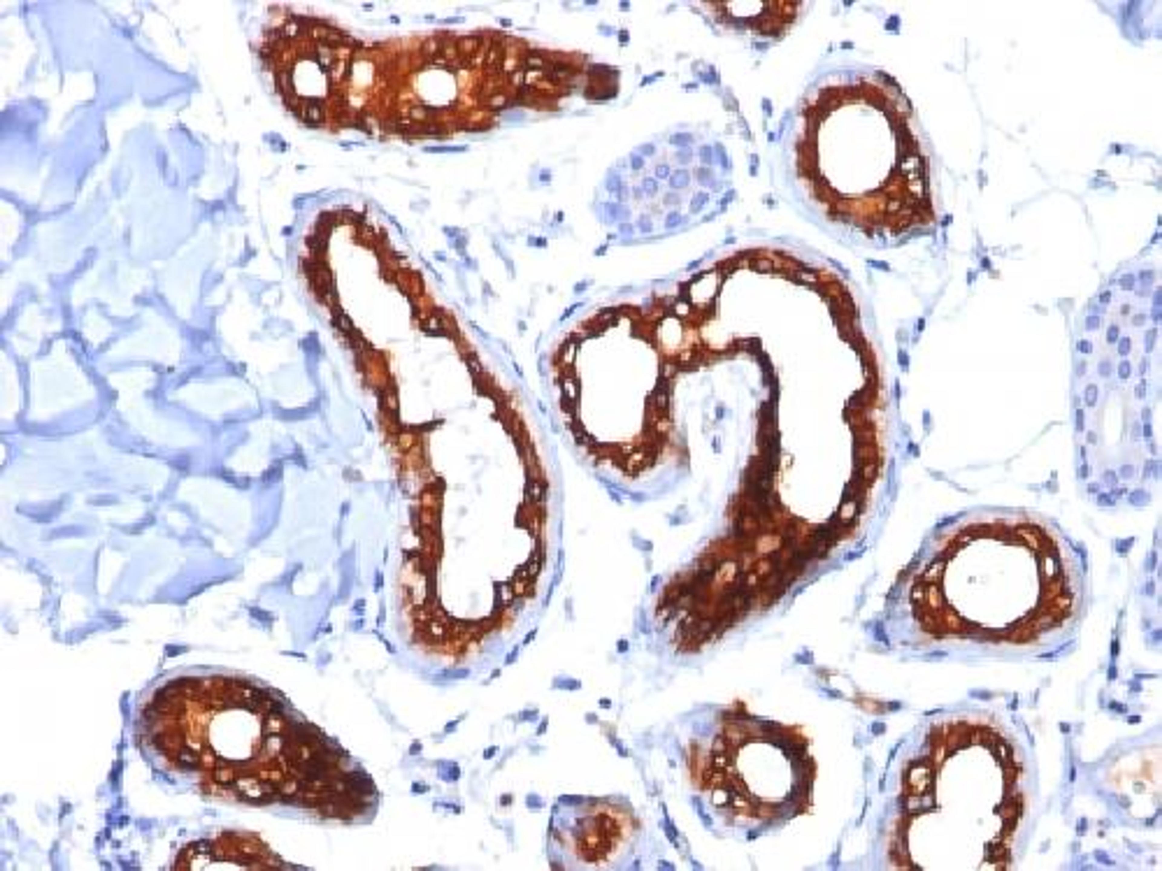 Immunohistochemical staining of human Skin tissue using KRT18 antibody