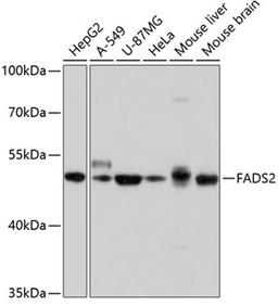 Western blot - FADS2 antibody (A10270)