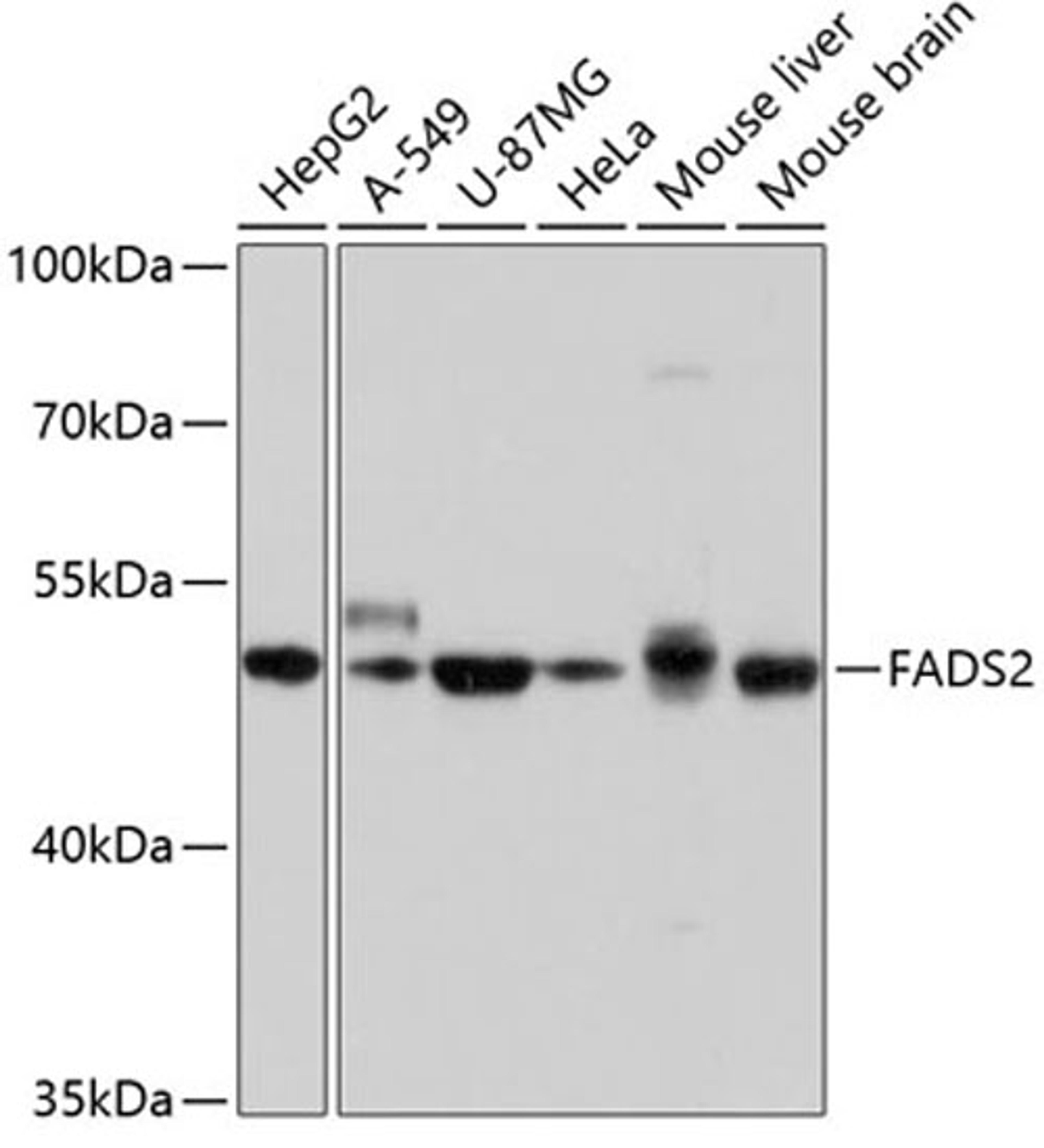 Western blot - FADS2 antibody (A10270)