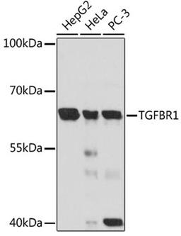 Western blot - TGFBR1 antibody (A0708)