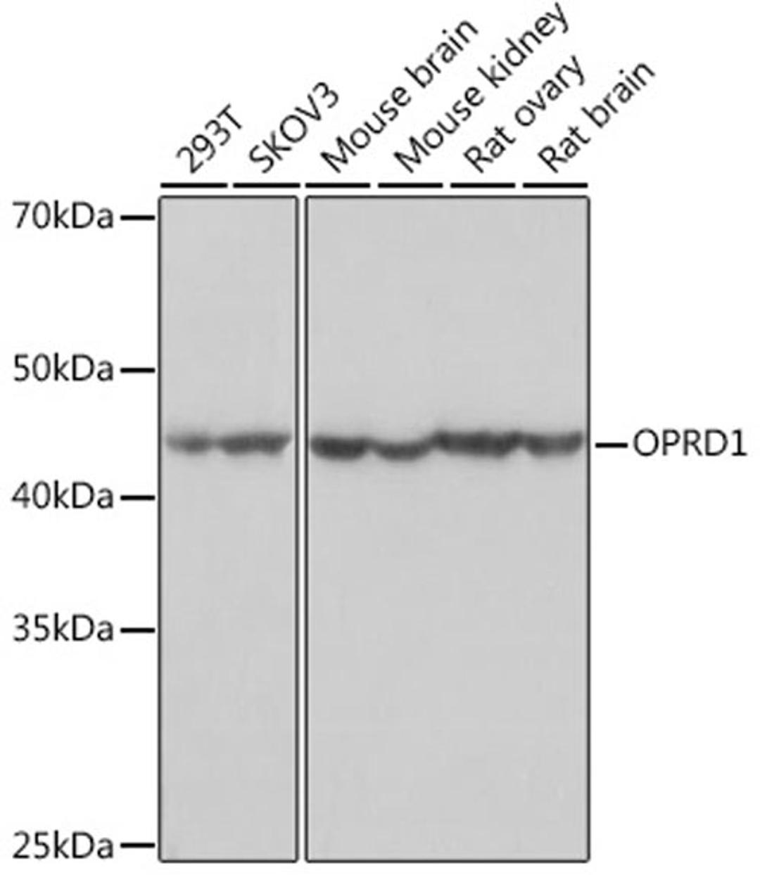 Western blot - OPRD1 Rabbit mAb (A8694)