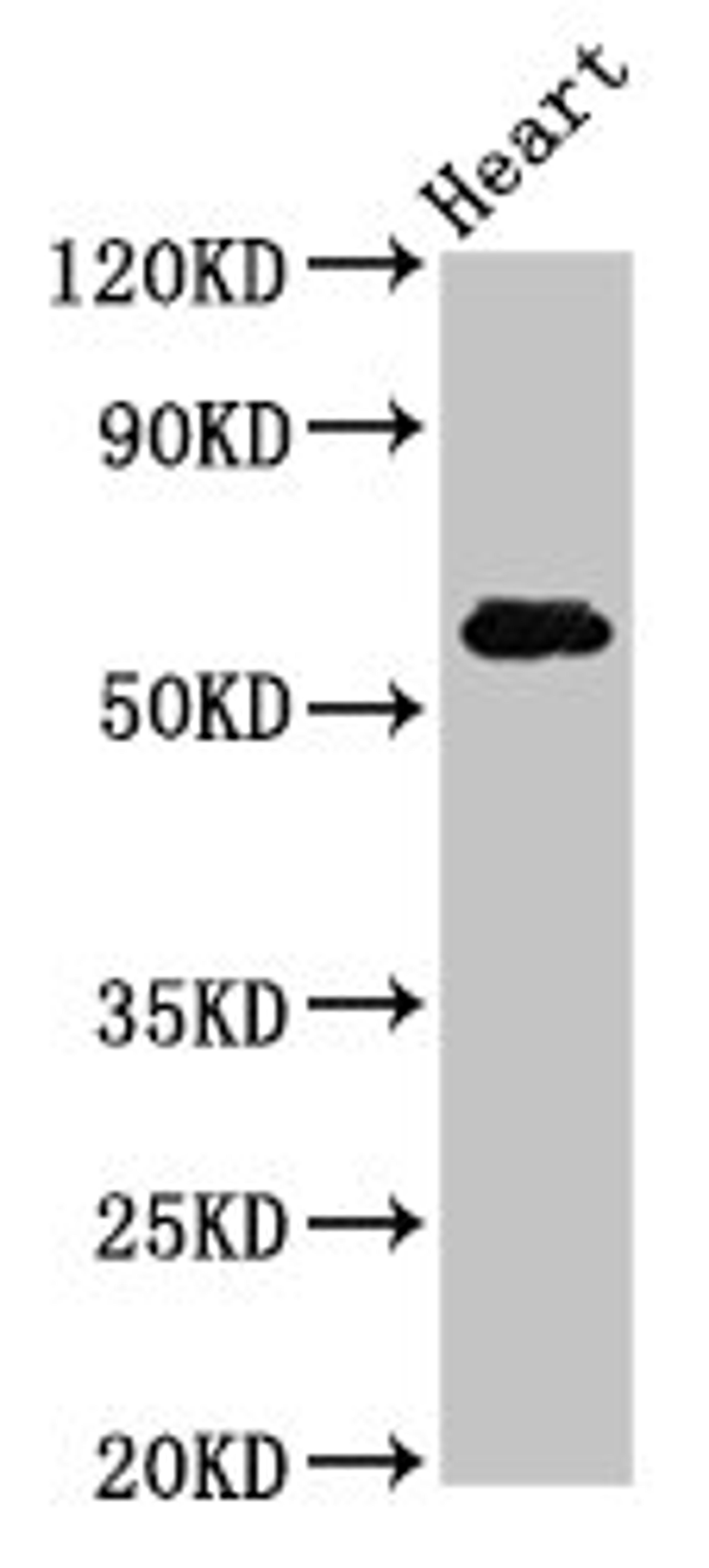 Western Blot. Positive WB detected in: Rat heart tissue. All lanes: SLC11A1 antibody at 5ug/ml. Secondary. Goat polyclonal to rabbit IgG at 1/50000 dilution. Predicted band size: 60, 48 kDa. Observed band size: 60 kDa. 