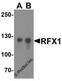 Western blot analysis of RFX1 in HeLa cell lysate with RFX1 antibody at (A) 1 and (B) 2 μg/ml.
