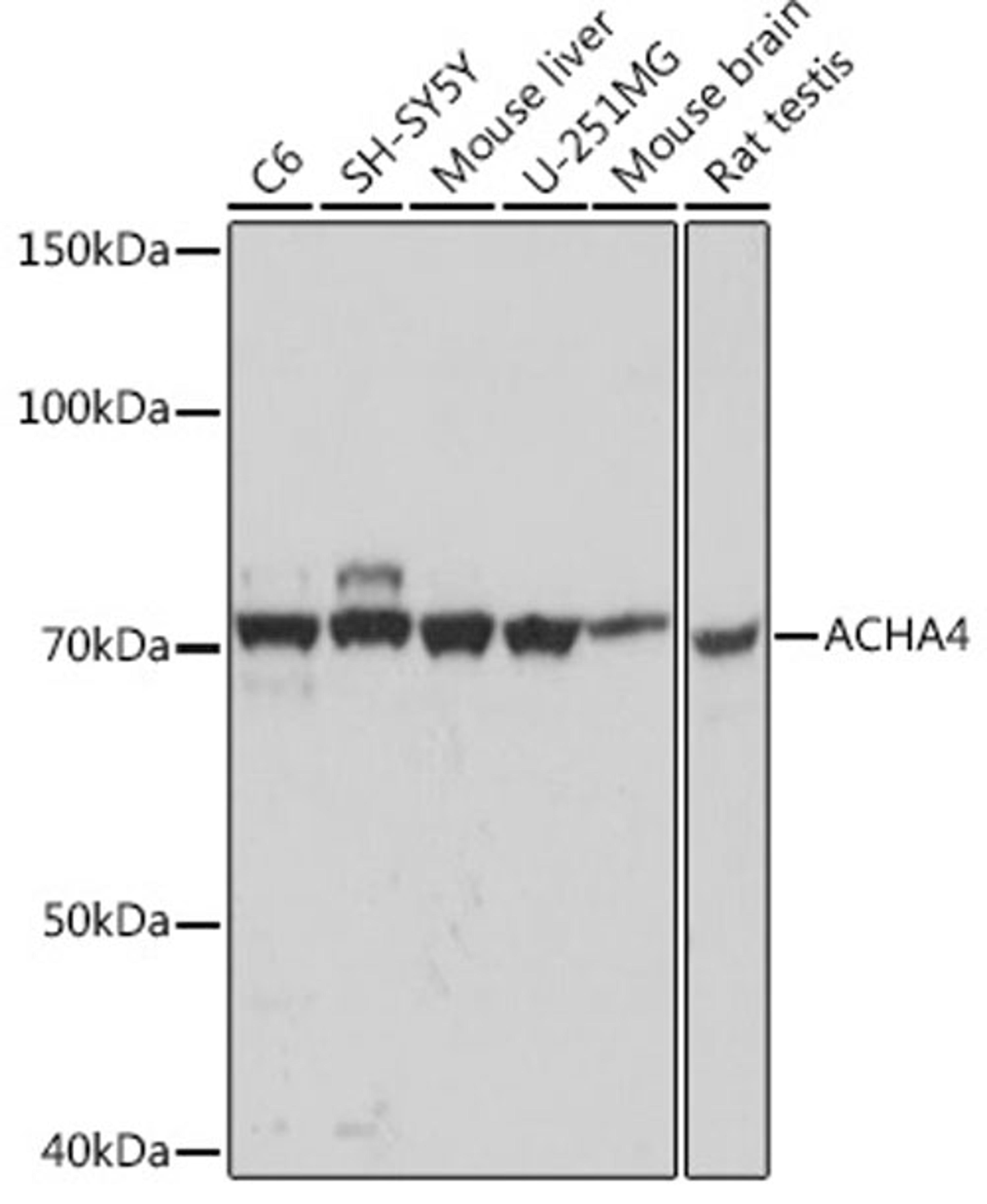 Western blot - ACHA4 Rabbit mAb (A0350)