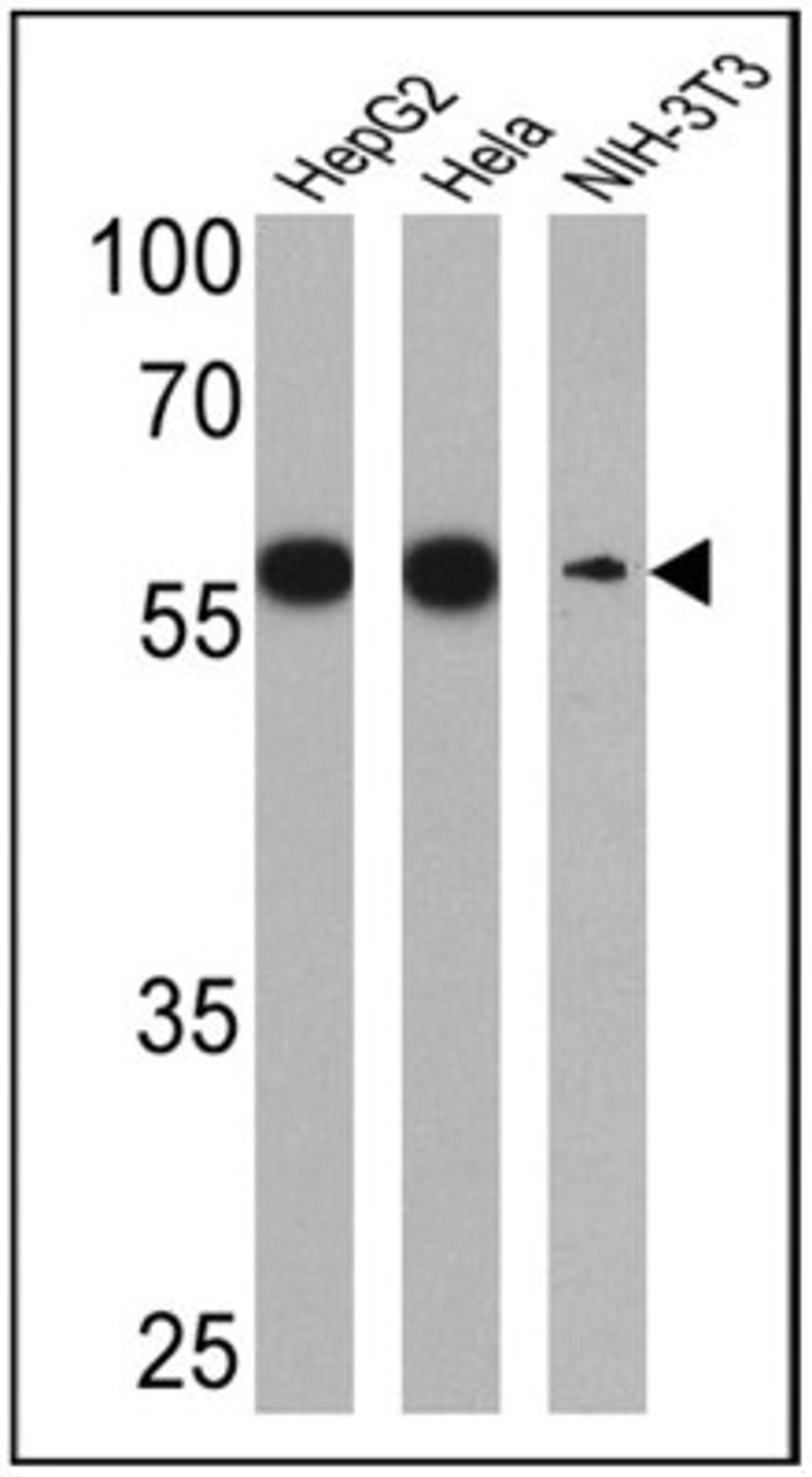 Western Blot: PDI Antibody (RL90) [NB300-517] - Analysis of PDI was performed by loading 25 ug of HepG2 (Lane 1), Hela (Lane 2) and NIH-3T3 (Lane 3) cell lysates.