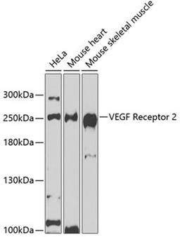 Western blot - VEGF Receptor 2 antibody (A5609)