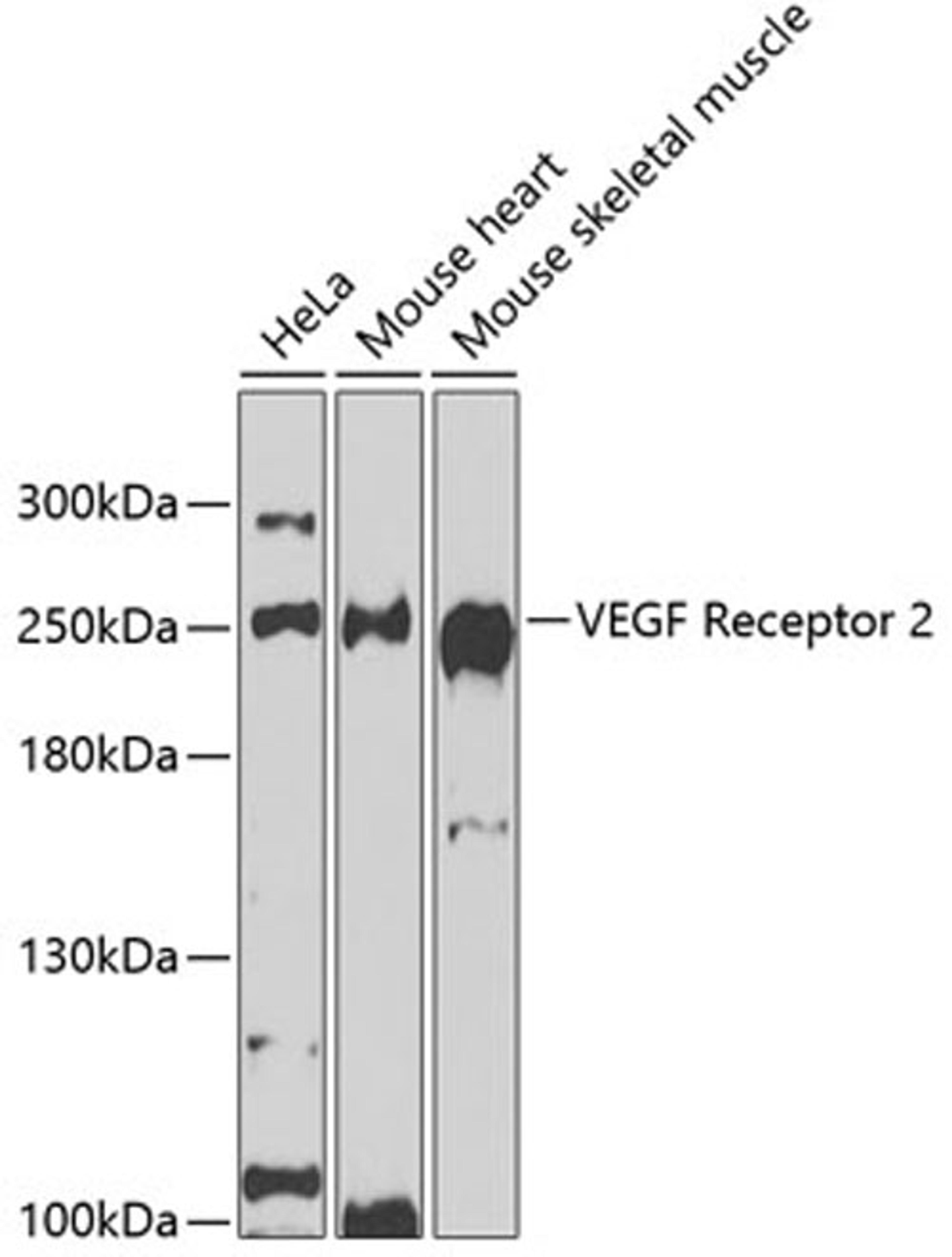 Western blot - VEGF Receptor 2 antibody (A5609)