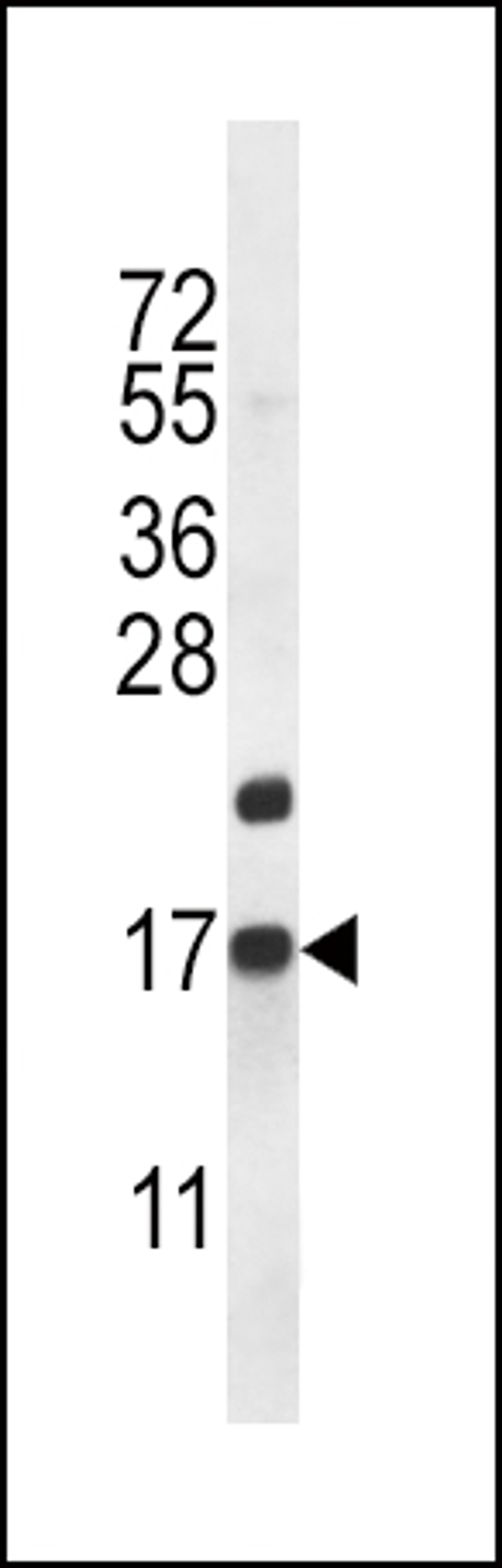 Western blot analysis in mouse heart tissue lysates (35ug/lane).