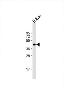 Western Blot at 1:2000 dilution + rat liver lysate Lysates/proteins at 20 ug per lane.