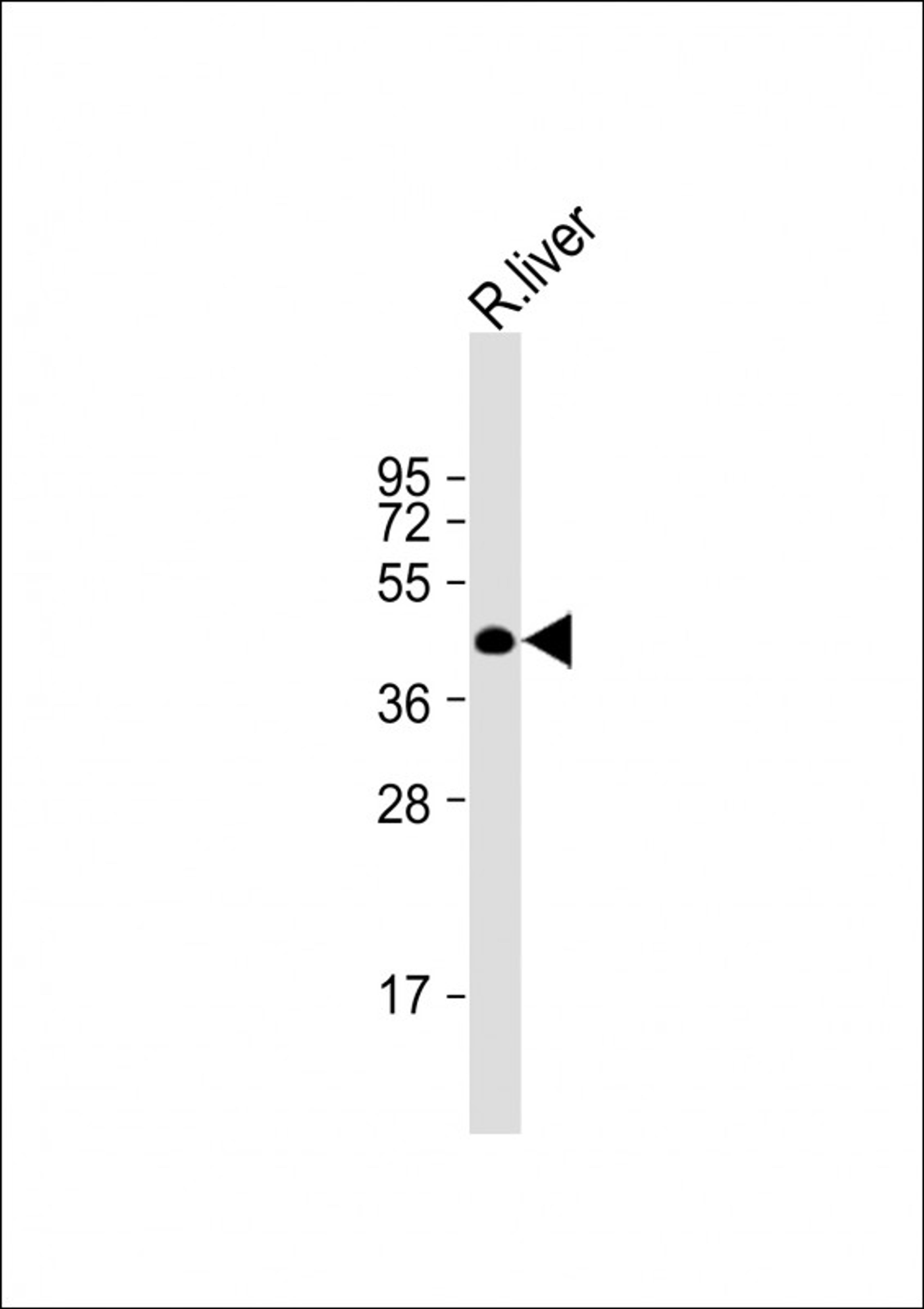 Western Blot at 1:2000 dilution + rat liver lysate Lysates/proteins at 20 ug per lane.