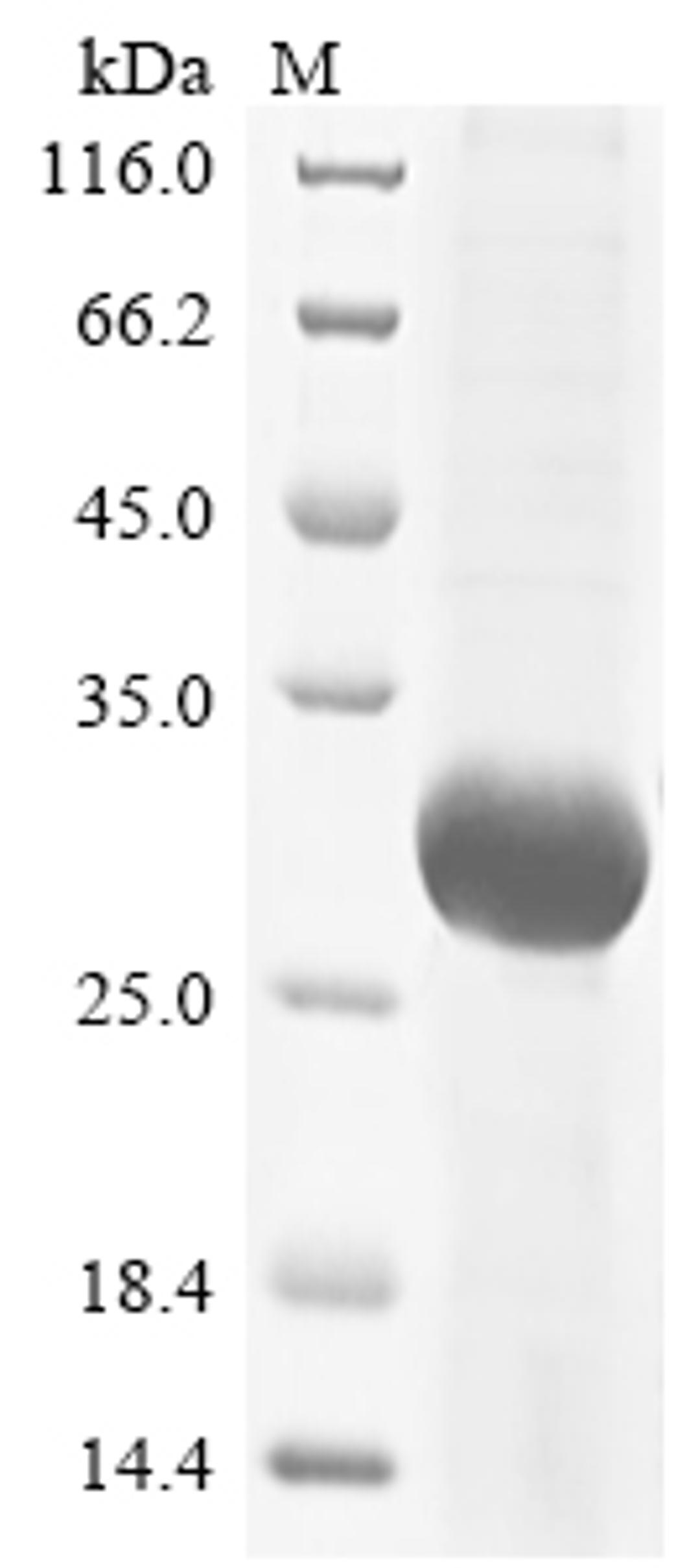 (Tris-Glycine gel) Discontinuous SDS-PAGE (reduced) with 5% enrichment gel and 15% separation gel.