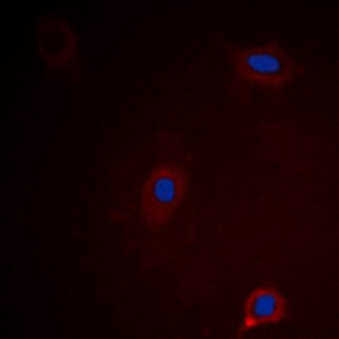 Immunofluorescense analysis of HEK293 cells using Ataxin 1 (phospho-S775) antibody