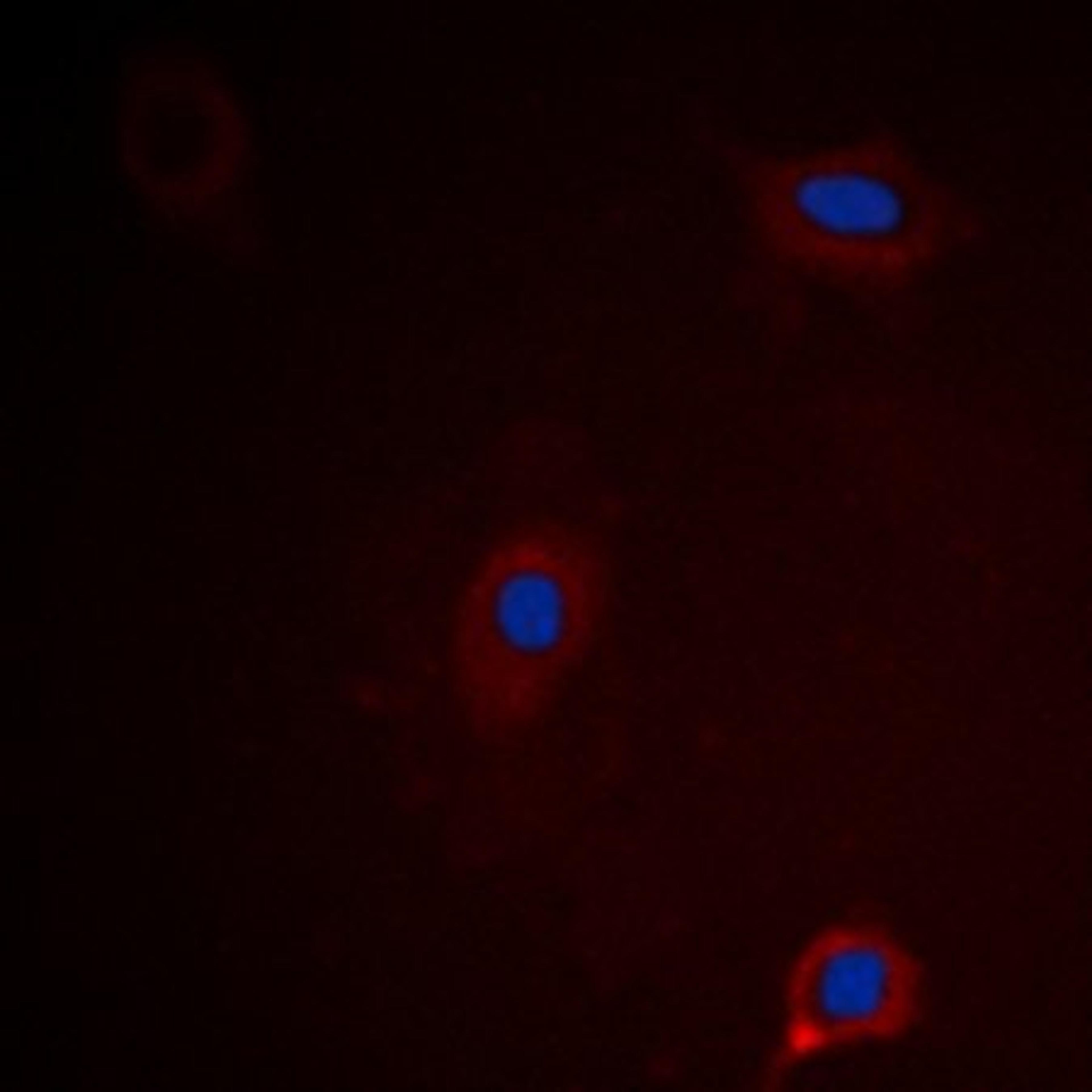 Immunofluorescense analysis of HEK293 cells using Ataxin 1 (phospho-S775) antibody