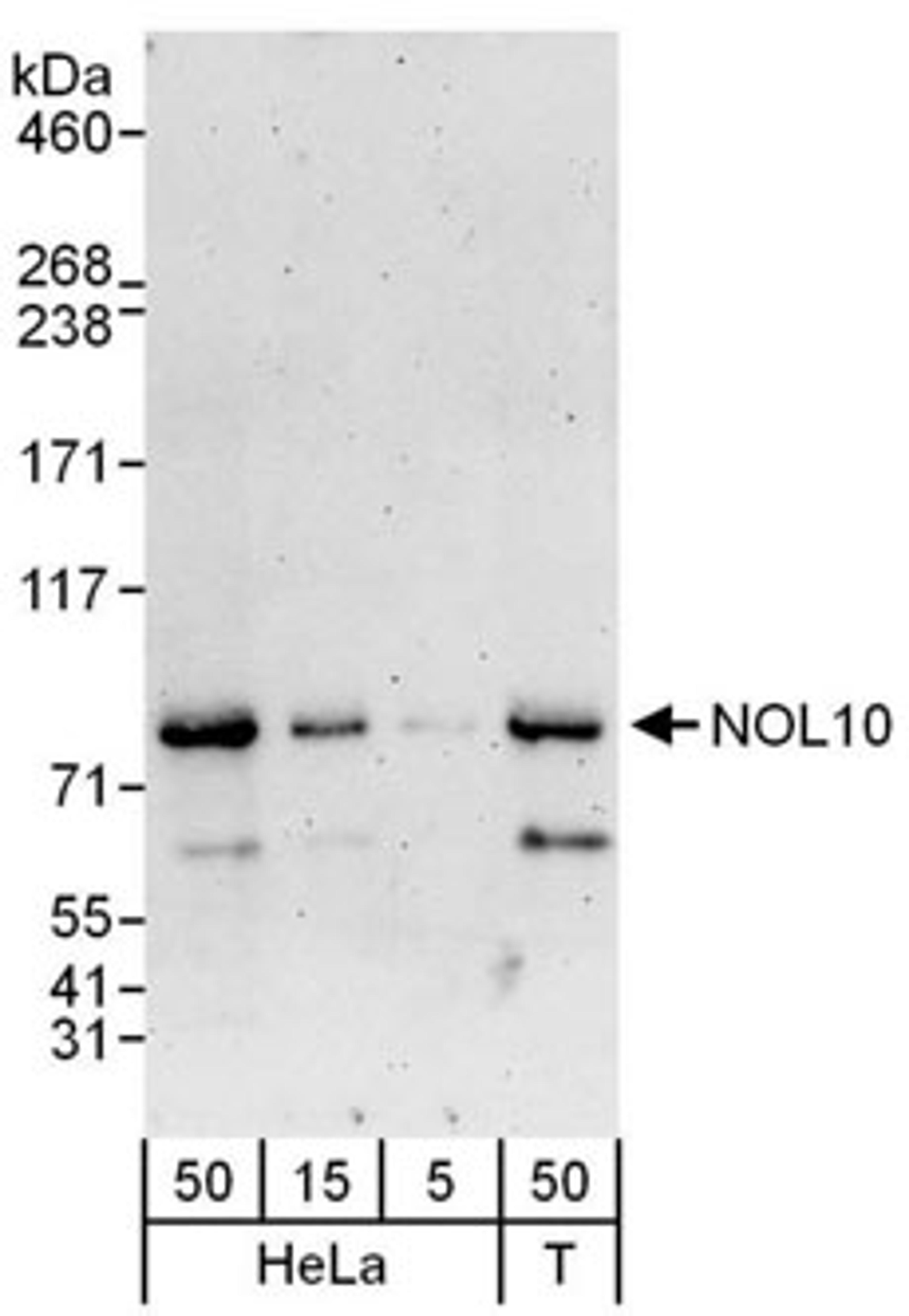 Detection of human NOL10 by western blot.