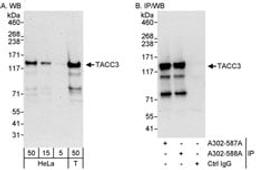 Detection of human TACC3 by western blot and immunoprecipitation.