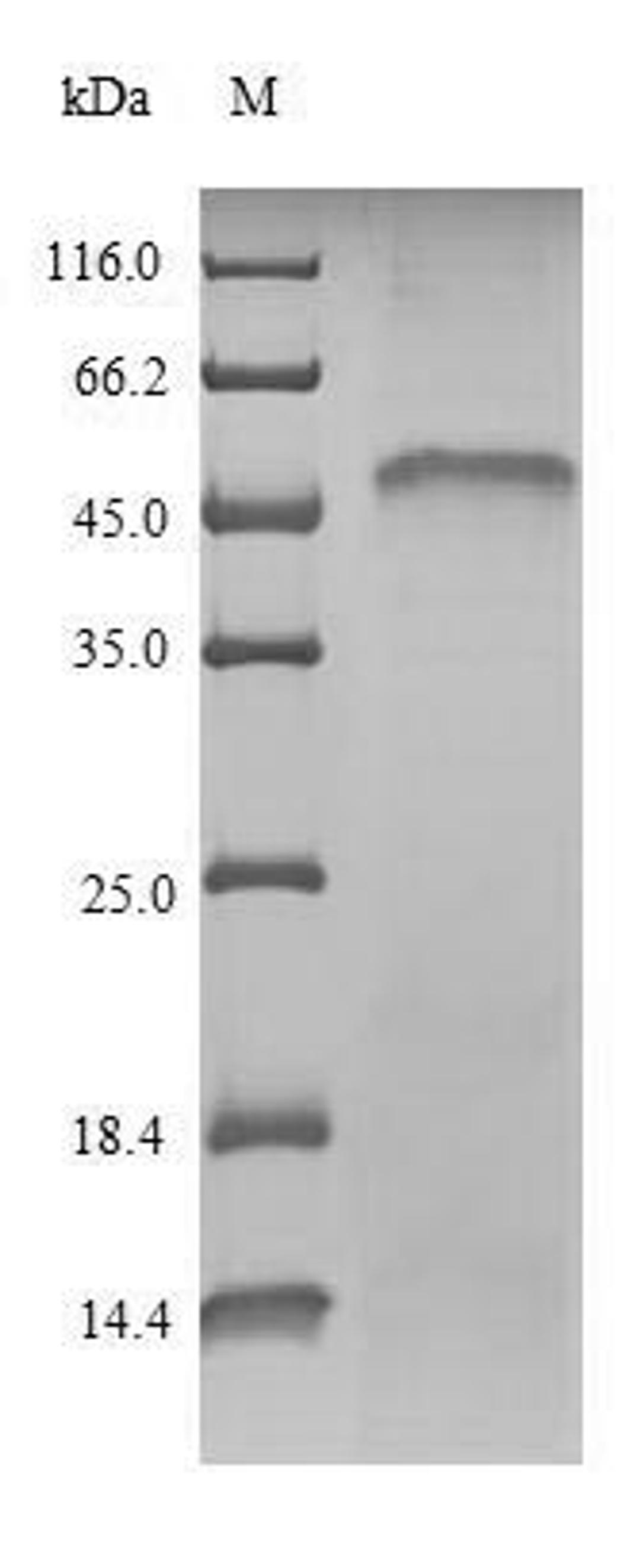 (Tris-Glycine gel) Discontinuous SDS-PAGE (reduced) with 5% enrichment gel and 15% separation gel.