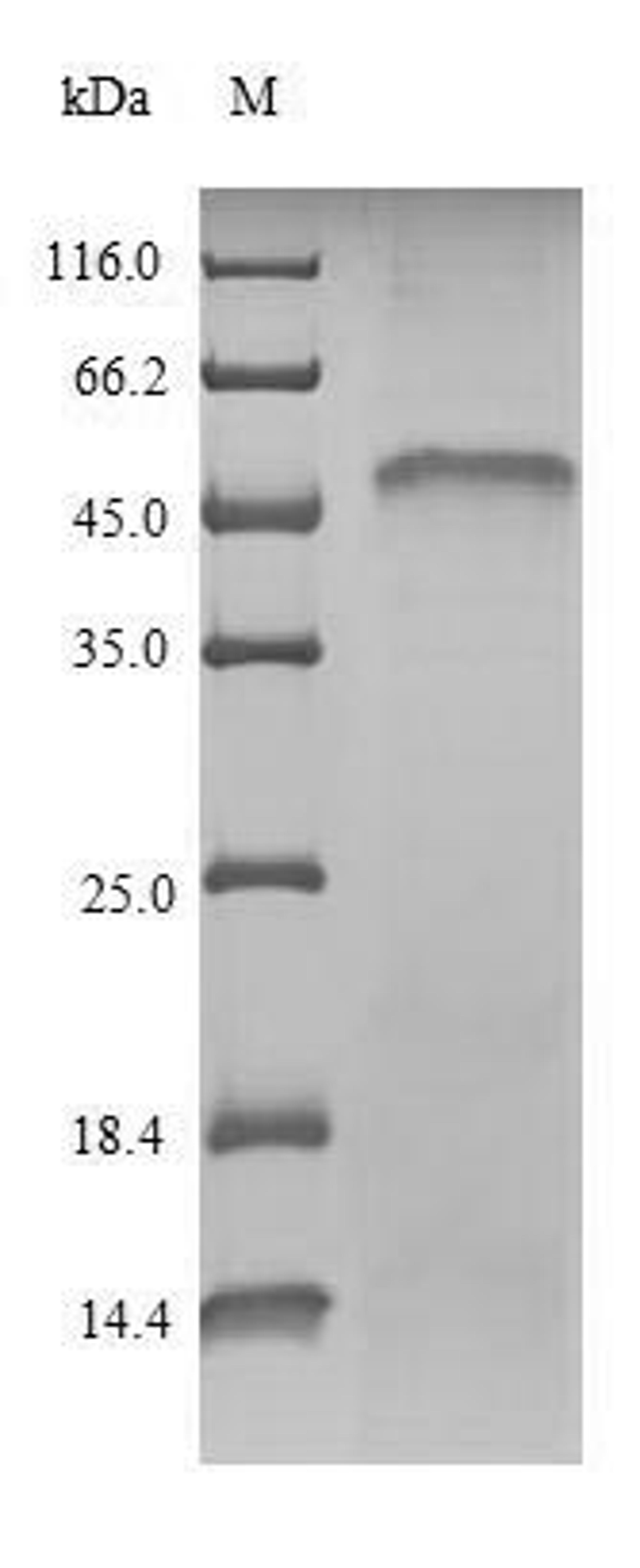 (Tris-Glycine gel) Discontinuous SDS-PAGE (reduced) with 5% enrichment gel and 15% separation gel.