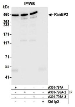 Detection of human RanBP2 by western blot of immunoprecipitates.