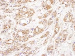 Detection of human P23 by immunohistochemistry.