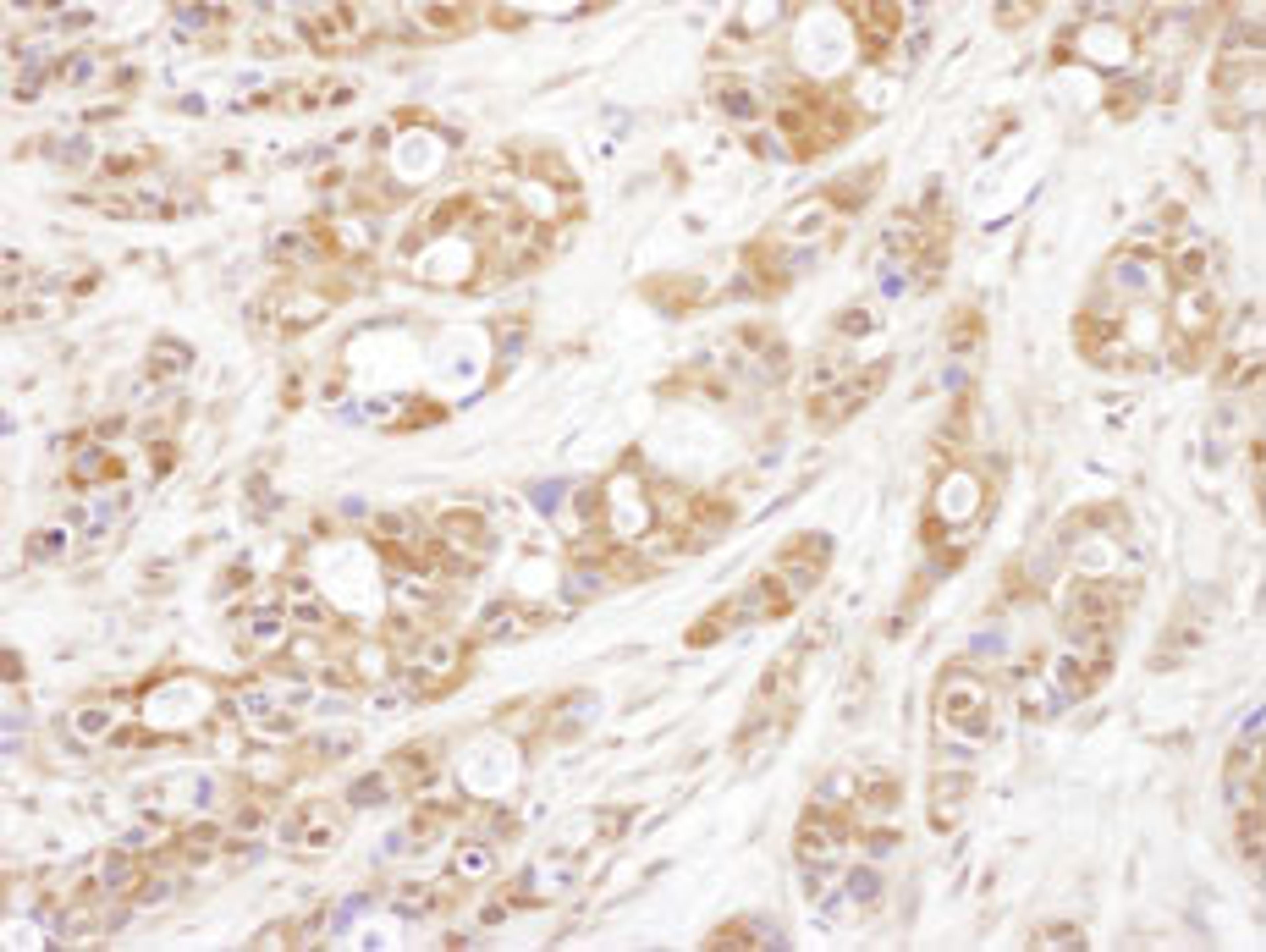 Detection of human P23 by immunohistochemistry.