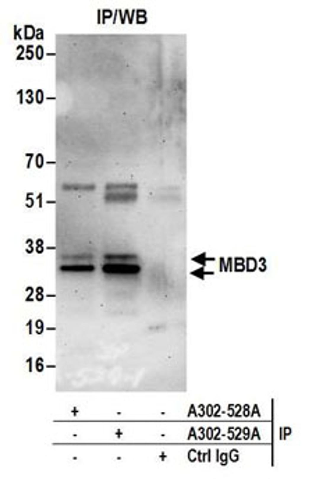 Detection of human MBD3 by western blot of immunoprecipitates.