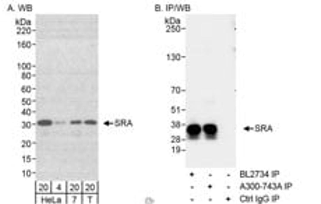 Detection of human SRA by western blot and immunoprecipitation.