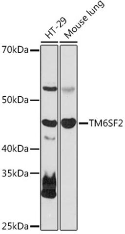 Western blot - TM6SF2 antibody (A18649)