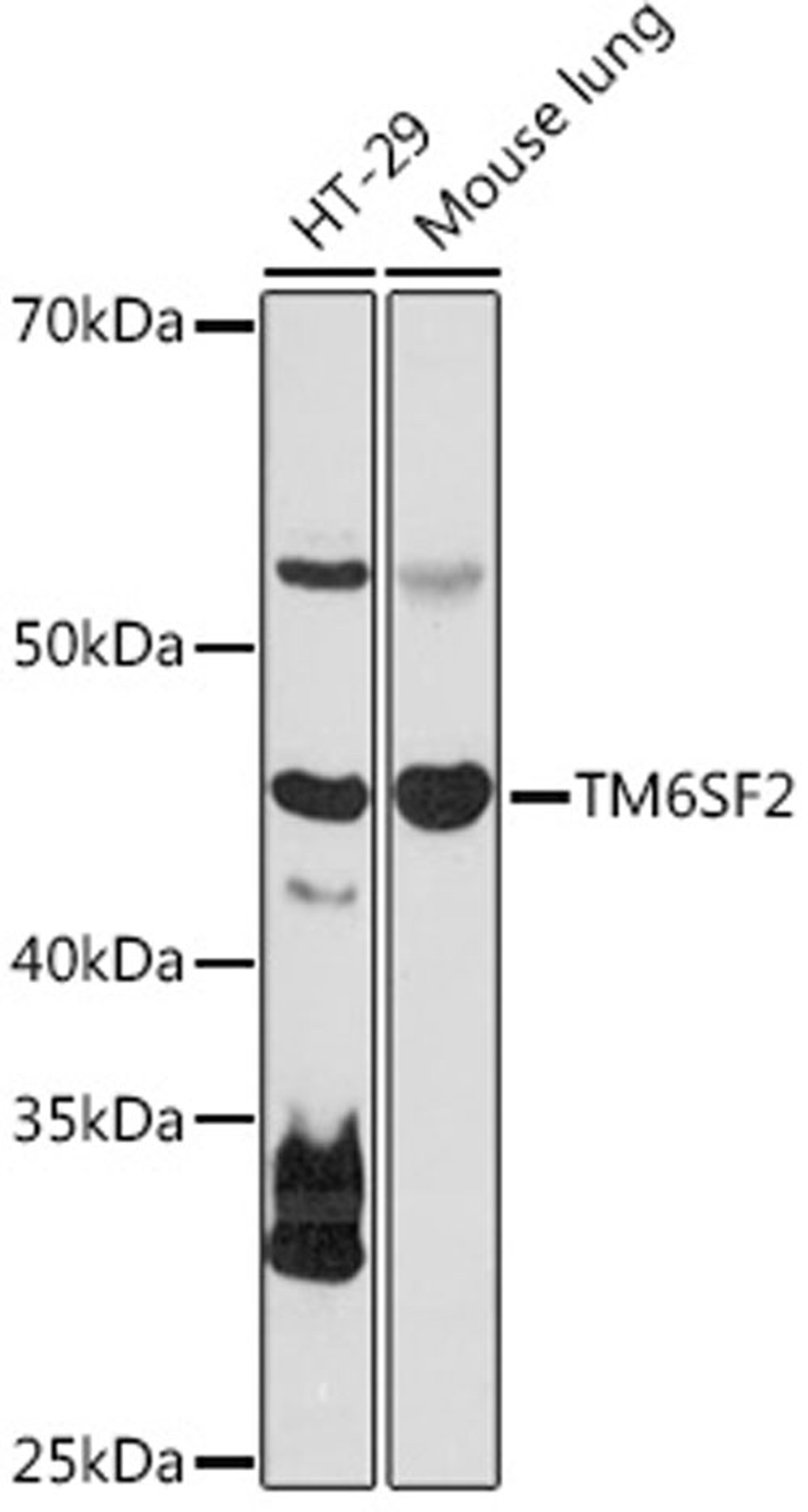 Western blot - TM6SF2 antibody (A18649)