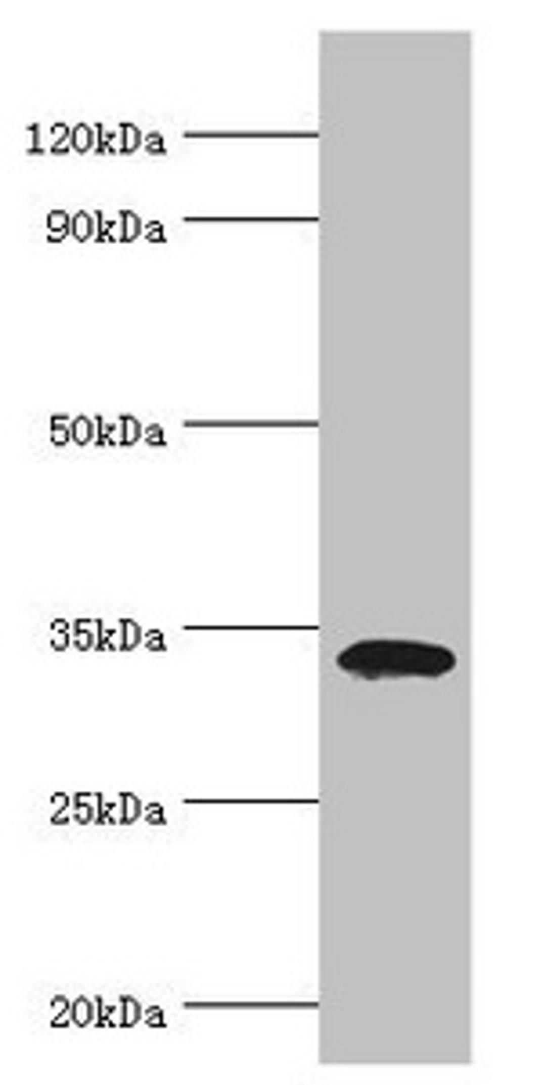 Western blot. All lanes: Low density lipoprotein receptor adapter protein 1 antibody at 4ug/ml + Mouse liver tissue. Secondary. Goat polyclonal to rabbit IgG at 1/10000 dilution. Predicted band size: 34 kDa. Observed band size: 34 kDa.