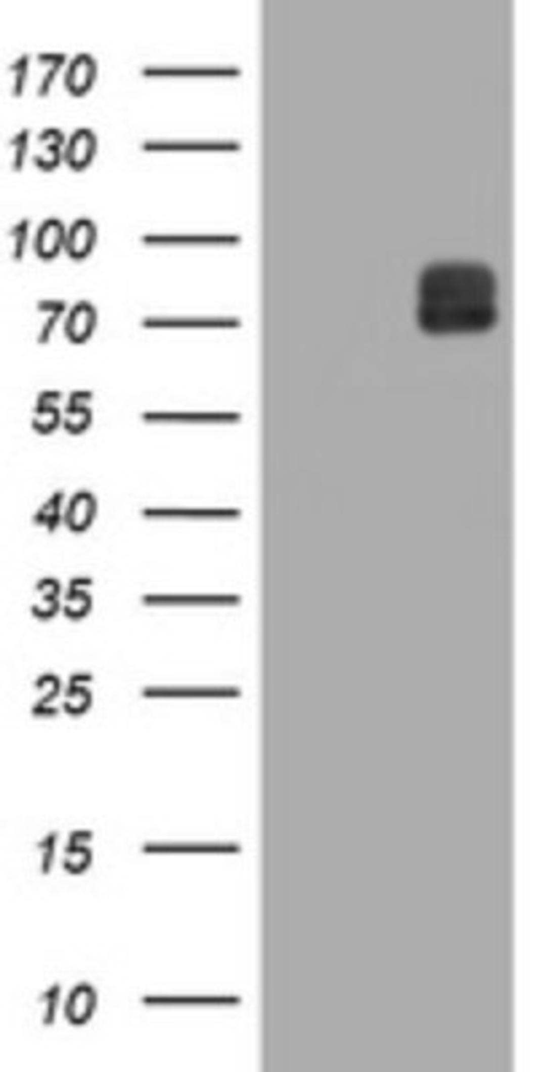 Western Blot: ITFG3 Antibody (3B3) [NBP2-45766] - Analysis of HEK293T cells were transfected with the pCMV6-ENTRY control (Left lane) or pCMV6-ENTRY ITFG .