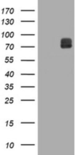 Western Blot: ITFG3 Antibody (3B3) [NBP2-45766] - Analysis of HEK293T cells were transfected with the pCMV6-ENTRY control (Left lane) or pCMV6-ENTRY ITFG .