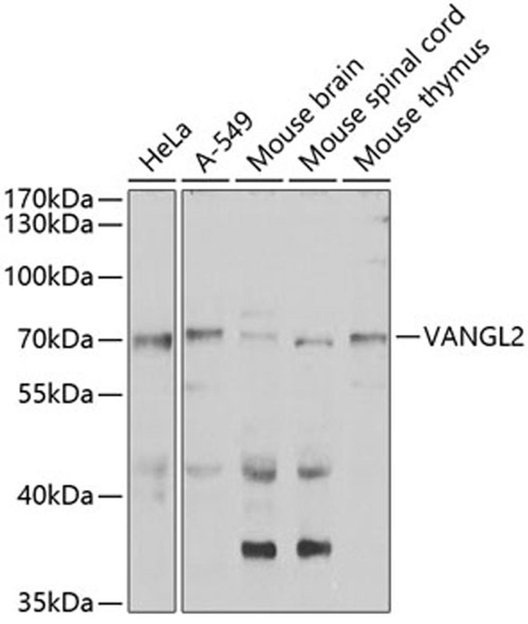 Western blot - VANGL2 antibody (A7825)