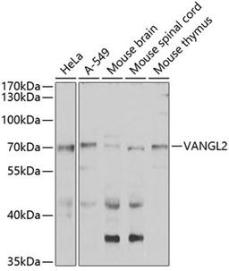 Western blot - VANGL2 antibody (A7825)