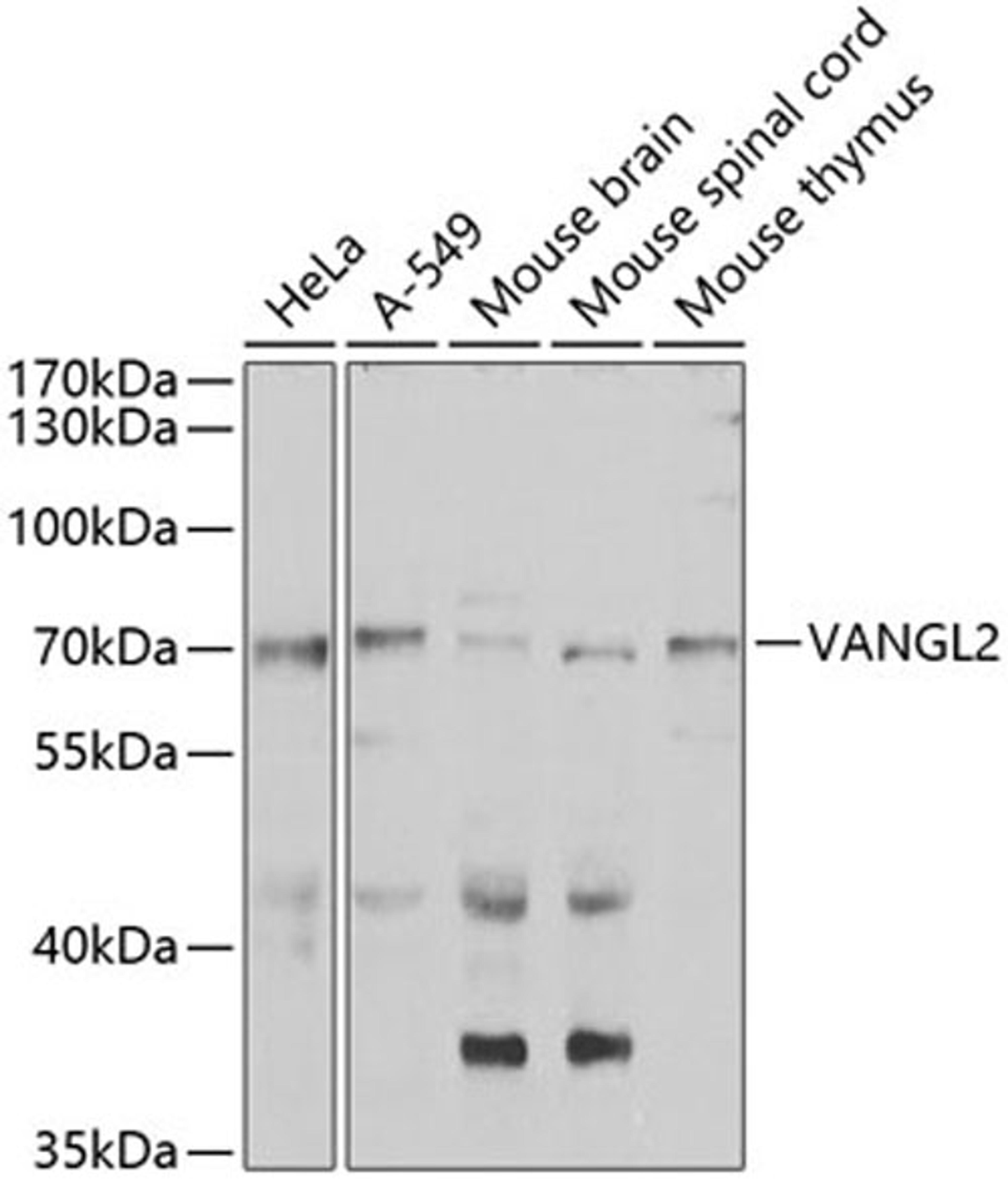 Western blot - VANGL2 antibody (A7825)