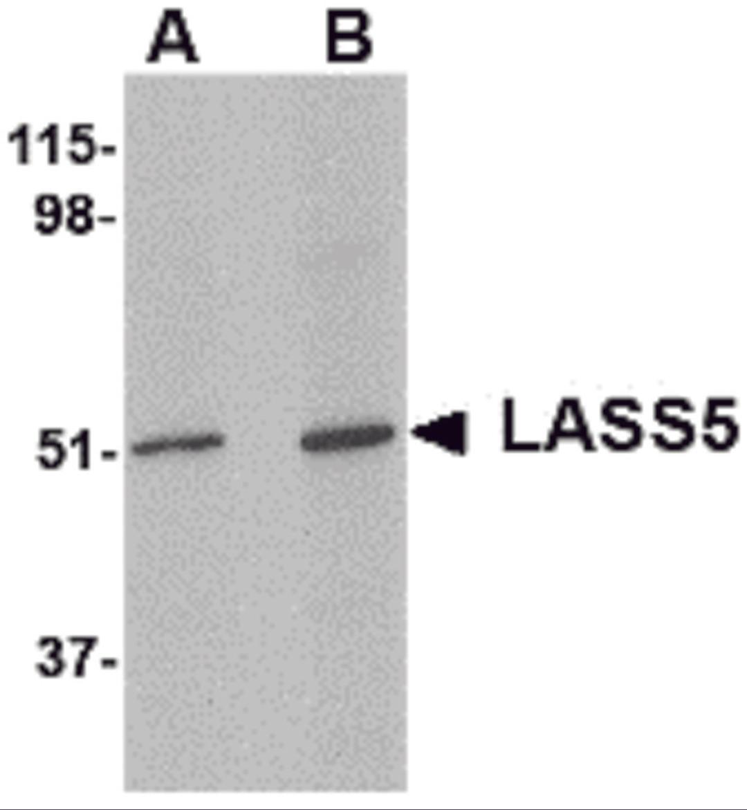 Western blot analysis of LASS5 in SK-N-SH lysate with LASS5 antibody at (A) 1 and (B) 2 μg/mL.