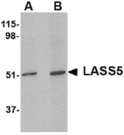 Western blot analysis of LASS5 in SK-N-SH lysate with LASS5 antibody at (A) 1 and (B) 2 μg/mL.