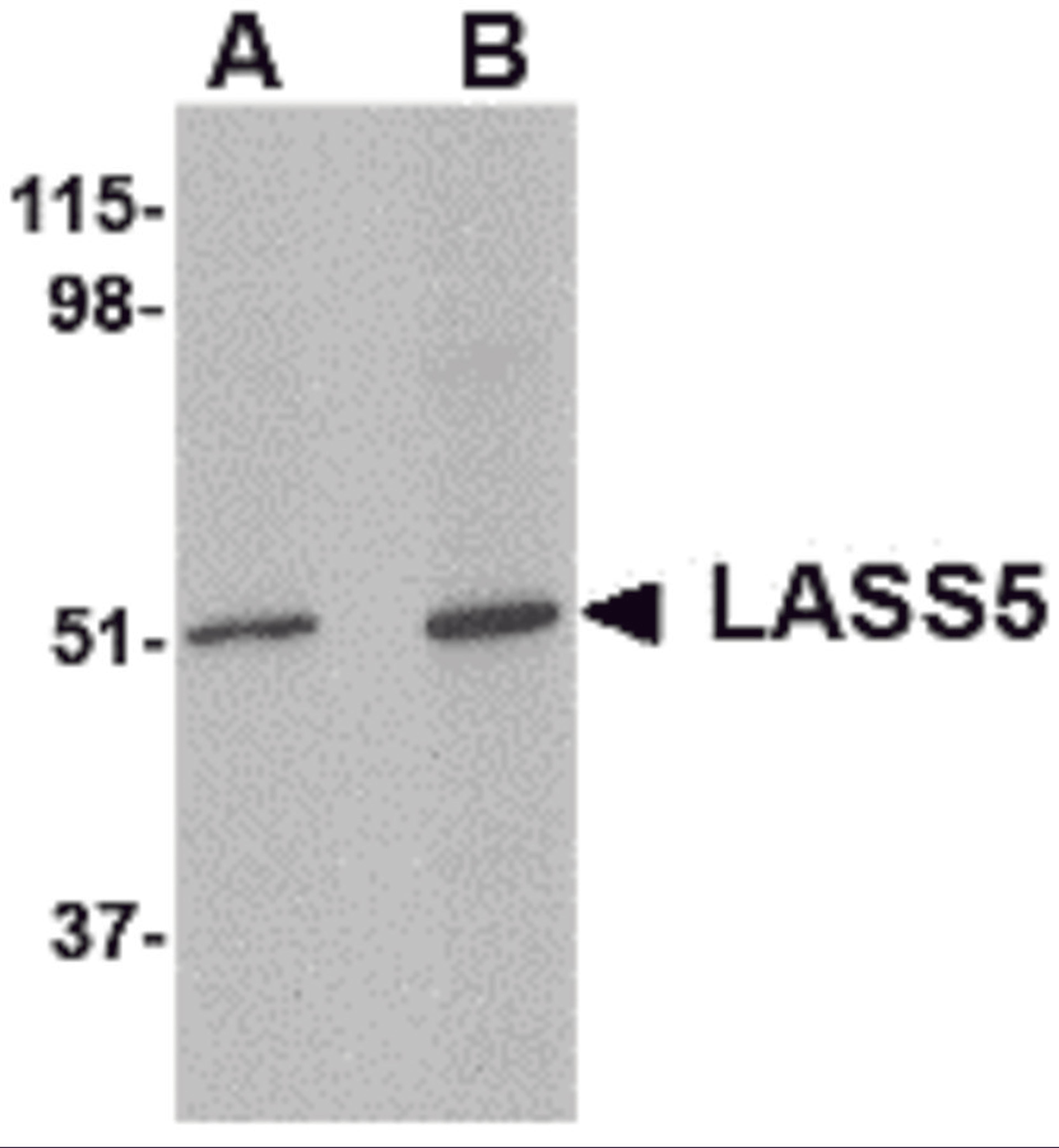 Western blot analysis of LASS5 in SK-N-SH lysate with LASS5 antibody at (A) 1 and (B) 2 μg/mL.