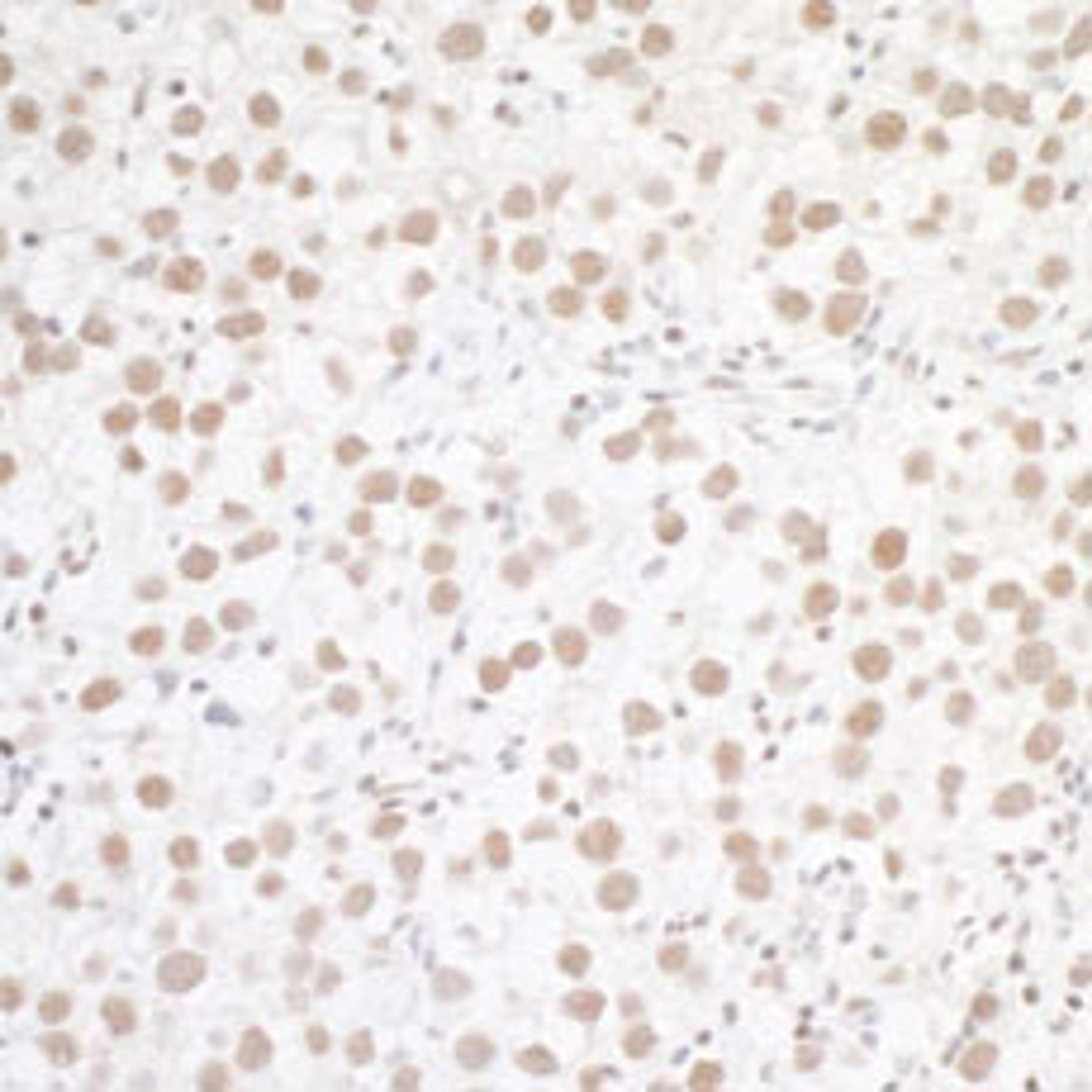 Detection of human WTAP by immunohistochemistry.