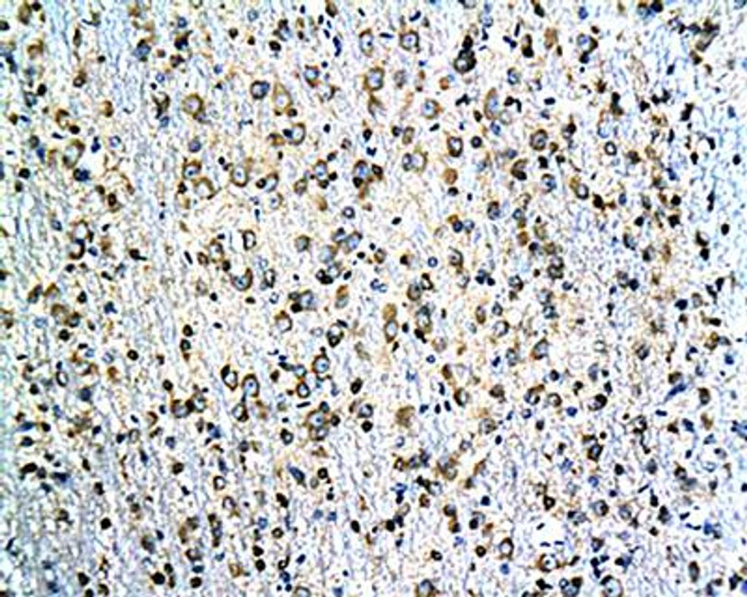 IHC-P of rat hippocampal tissue(Tau antibody at 1:200) 